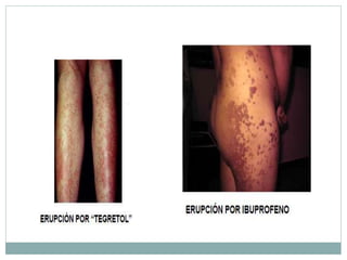 FARMACOVIGILANCIA Y RAM.ppt