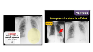 image critique in radiography by Atif | PDF