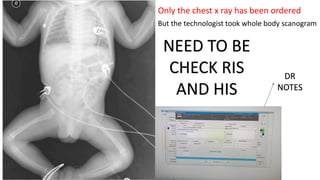 image critique in radiography by Atif | PDF