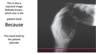 image critique in radiography by Atif | PDF