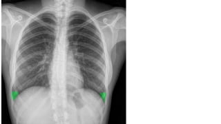 image critique in radiography by Atif | PDF