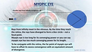 Prepared by: Qurat-Ul-Ain
Rays from infinity meet in the vitreous. By the time they reach
the retina, the rays have diverged to form a blur circle – not a
focal point.
Myopic eye is too long for its converging power or you can say
myopic eye has too much converging power for its length.
A
Parallel rays from infinity (vergence = 0)
To be conjugate with the retina, the far point of myopic eye will
have to offset its excess convergence with an equivalent amount
of divergence.
MYOPIC EYE
 