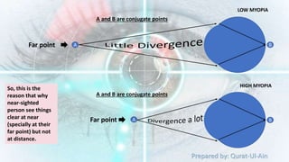 Prepared by: Qurat-Ul-Ain
A B
Far point
A and B are conjugate points
LOW MYOPIA
A B
Far point
A and B are conjugate points
HIGH MYOPIA
So, this is the
reason that why
near-sighted
person see things
clear at near
(specially at their
far point) but not
at distance.
 