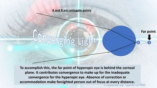 Prepared by: Qurat-Ul-Ain
A
B
Far point
A and B are conjugate points
To accomplish this, the far point of hyperopic eye is behind the corneal
plane. It contributes convergence to make up for the inadequate
convergence for the hyperopic eye. Absence of correction or
accommodation make farsighted person out of focus at every distance.
 
