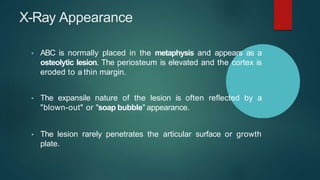 X-Ray Appearance
• ABC is normally placed in the metaphysis and appears as a
osteolytic lesion. The periosteum is elevated and the cortex is
eroded to a thin margin.
• The expansile nature of the lesion is often reflected by a
"blown-out" or "soap bubble" appearance.
• The lesion rarely penetrates the articular surface or growth
plate.
 