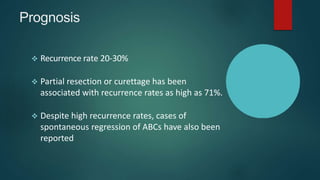 Prognosis
 Recurrence rate 20-30%
 Partial resection or curettage has been
associated with recurrence rates as high as 71%.
 Despite high recurrence rates, cases of
spontaneous regression of ABCs have also been
reported
 