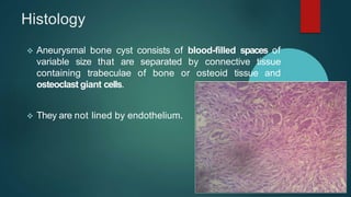Histology
 Aneurysmal bone cyst consists of blood-filled spaces of
variable size that are separated by connective tissue
containing trabeculae of bone or osteoid tissue and
osteoclast giant cells.
 They are not lined by endothelium.
 