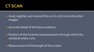  Axial, sagittal, and coronal thin-cut (1-mm) reconstruction
images.
 Accurate detail of the bony anatomy.
 Position of the foramen transversarium through which the
vertebral artery runs.
 Measurement of the length of the screws
15
 