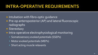  Intubation with fibro-optic guidance
 Pre-op anteroposterior (AP) and lateral fluoroscopic
radiographs
 Stereotaxy
 Intra-operative electrophysiological monitoring
 Somatosensory evoked potentials (SSEPs)
 Motor evoked potentials (MEPs)
 Short acting muscle relaxants
19
 