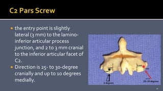  the entry point is slightly
lateral (3 mm) to the lamino-
inferior articular process
junction, and 2 to 3 mm cranial
to the inferior articular facet of
C2.
 Direction is 25- to 30-degree
cranially and up to 10 degrees
medially.
27
 
