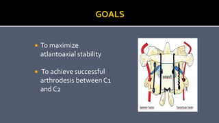  To maximize
atlantoaxial stability
 To achieve successful
arthrodesis betweenC1
and C2
 