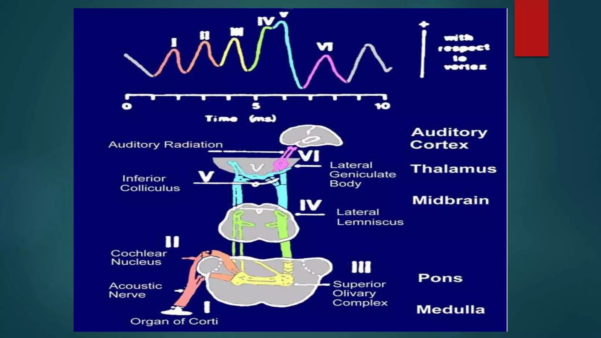 Intraoperative Neurophysiological Monitoring Brain | PPTX