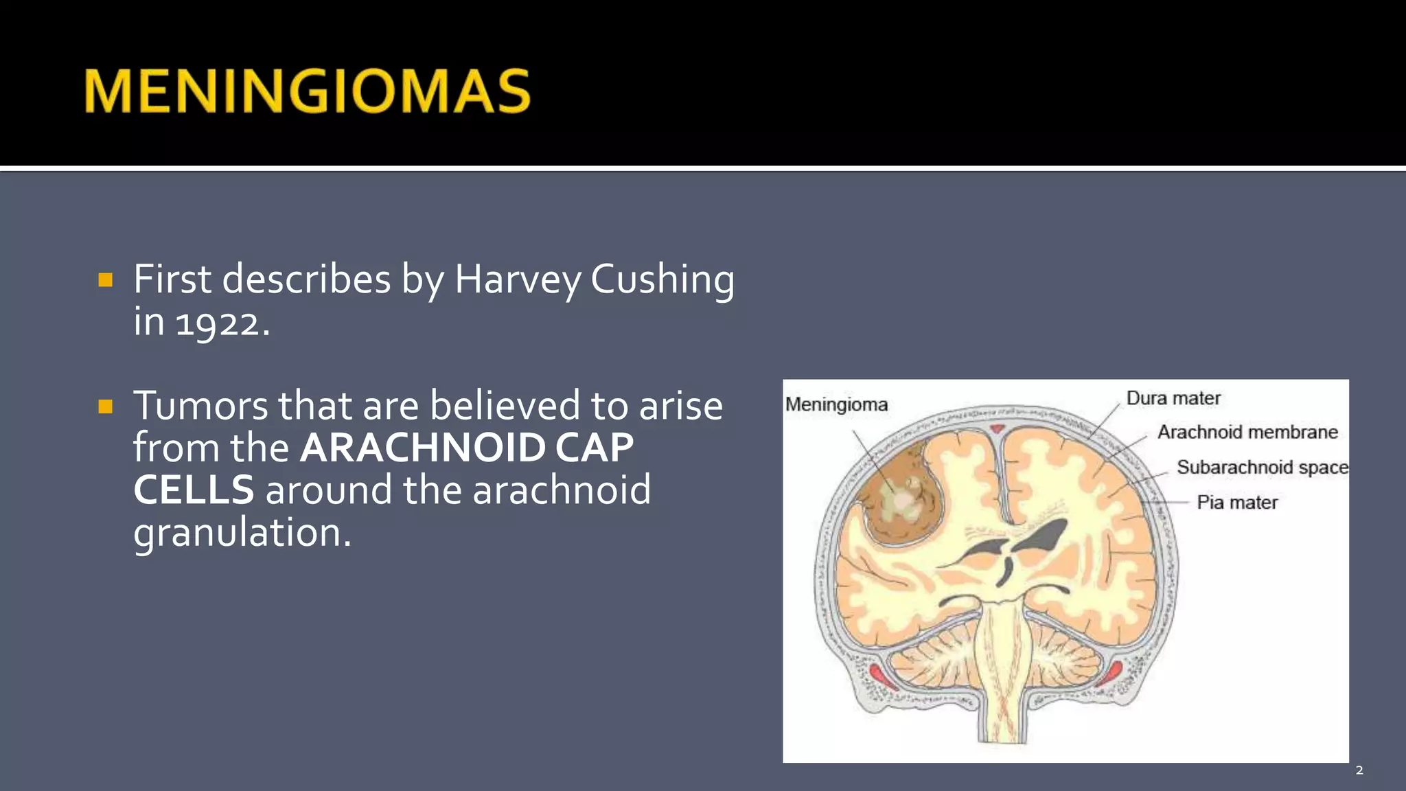Parasagittal Meningioma PPTX Parasagittal Meningioma PPTX
