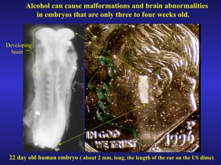 Alcohol can cause malformations and brain abnormalities  in embryos that are only three to four weeks old. 22 day old human embryo  ( about 2 mm. long, the length of the ear on the US dime)   Developing brain 