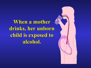 When a mother drinks, her unborn child is exposed to alcohol. 