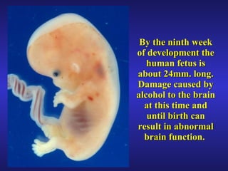 By the ninth week of development the human fetus is about 24mm. long. Damage caused by alcohol to the brain at this time and until birth can result in abnormal brain function.  
