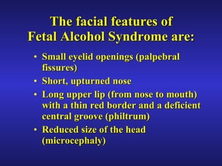 The facial features of Fetal Alcohol Syndrome are: Small eyelid openings (palpebral fissures) Short, upturned nose Long upper lip (from nose to mouth) with a thin red border and a deficient central groove (philtrum)  Reduced size of the head (microcephaly) 