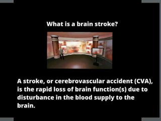 Brain Stroke FAS