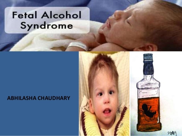 Реферат: Fetal Alcohol Syndrome And Fetal Alcohol Effects