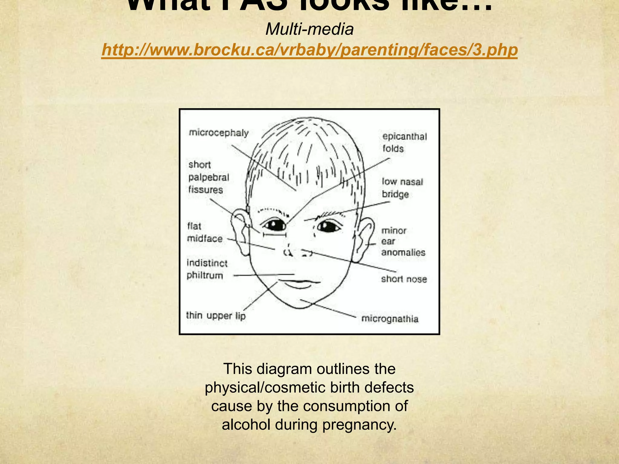 The awareness colour of FAS is blue.