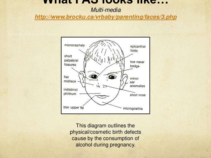 Animal abuse essay words fetal alcohol syndrome essay