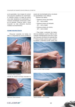 ça da gravidade, mas incapaz de vencer
uma pequena resistência do examinador;
4- músculo contrai e é capaz de vencer
uma certa resistência do examinador; 5-
músculo considerado normal para o bióti-
po do paciente. Pode-se medir a força
muscular na mão utilizando diversos
modelos de dinamômetros.
EXAME NEUROLÓGICO
Pesquisar seqüelas de lesões do
SNC e a integridade de nervos periféricos
através do estudo da força muscular no
exame da movimentação ativa, do estudo
da sensibilidade e dos reflexos.
Extensor dos dedos:
– Extensor comum dos dedos
{C7 – nervo radial}
– Extensor próprio do indicador
{C7 – nervo radial}
– Extensor próprio do mínimo
{C7 – nervo radial}
• Para testar a extensão dos dedos,
deve-se estabilizar o punho e fletir as arti-
culações interfalangianas para tirar a ação
dos músculos intrínsecos na extensão das
IF. Nessa posição pede-se para o pacien-
te realizar a extensão da MF contra uma
23
ATUALIZAÇÃO EM TRAUMATOLOGIA DO APARELHO LOCOMOTOR
Teste para o flexor superficial.
Teste do extensor longo do polegar.
Teste do extensor curto do polegar.Teste para o flexor profundo.
 