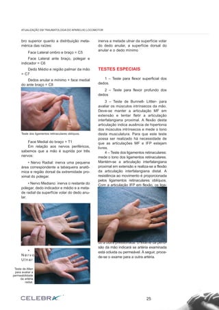 bro superior quanto a distribuição meta-
mérica das raízes:
Face Lateral ombro e braço = C5
Face Lateral ante braço, polegar e
indicador = C6
Dedo Médio e região palmar da mão
= C7
Dedos anular e mínimo + face medial
do ante braço = C8
Face Medial do braço = T1
Em relação aos nervos periféricos,
sabemos que a mão é suprida por três
nervos:
• Nervo Radial: inerva uma pequena
área correspondente a tabaqueira anatô-
mica e região dorsal da extremidade pro-
ximal do polegar.
• Nervo Mediano: inerva o restante do
polegar, dedo indicador e médio e a meta-
de radial da superfície volar do dedo anu-
lar.
•
N e r v o
U l n a r :
inerva a metade ulnar da superfície volar
do dedo anular, a superfície dorsal do
anular e o dedo mínimo
TESTES ESPECIAIS
1 – Teste para flexor superficial dos
dedos.
2 – Teste para flexor profundo dos
dedos
3 – Teste de Bunnell- Littler- para
avaliar os músculos intrínsecos da mão.
Deve-se manter a articulação MF em
extensão e tentar fletir a articulação
interfalangiana proximal. A flexão desta
articulação indica ausência de hipertonia
dos músculos intrínsecos e mede o tono
desta musculatura. Para que este teste
possa ser realizado há necessidade de
que as articulações MF e IFP estejam
livres.
4 – Teste dos ligamentos retinaculares:
mede o tono dos ligamentos retinaculares.
Mantém-se a articulação interfalangiana
proximal em extensão e realiza-se a flexão
da articulação interfalangiana distal. A
resistência ao movimento é proporcionada
pelos ligamentos retinaculares oblíquos.
Com a articulação IFP em flexão, os liga-
mentos retinaculares se relaxam e permi-
tem a flexão da IFP com maior facilidade.
5 – Teste de Allen: o objetivo deste tes-
te é avaliar a permeabilidade das artérias
radial e ulnar. Deve-se pedir para o pacien-
te abrir e fechar a mão várias vezes, com
vigor e rapidez, enquanto o examinador
comprime as artérias radial e ulnar ao nível
do punho. Com os vasos comprimidos,
pede-se para o paciente abrir a mão e,
então, libera-se uma das artérias manten-
do a outra pressionada. O exame da perfu-
são da mão indicará se artéria examinada
está ocluida ou permeável. À seguir, proce-
de-se o exame para a outra artéria.
25
ATUALIZAÇÃO EM TRAUMATOLOGIA DO APARELHO LOCOMOTOR
Teste dos ligamentos retinaculares oblíquos.
Teste de Allen
para avaliar a
permeabilidade
da artéria
radial.
 