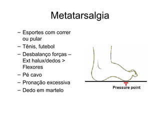 Metatarsalgia Esportes com correr ou pular Tênis, futebol Desbalanço forças – Ext halux/dedos > Flexores Pé cavo Pronação excessiva Dedo em martelo 