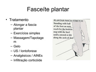 Fasceíte plantar Tratamento Alongar a fascia plantar Exercícios simples Massagem/Tapotagem Gelo US / Iontoforese Analgésicos / AINEs Infiltração corticóide 
