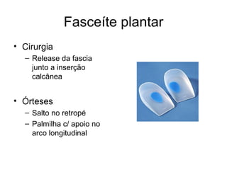 Fasceíte plantar Cirurgia Release da fascia junto a inserção calcânea Órteses Salto no retropé Palmilha c/ apoio no arco longitudinal 