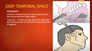 fascial space.pptx