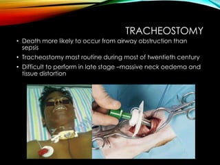 TRACHEOSTOMY 
• Death more likely to occur from airway obstruction than 
sepsis 
• Tracheostomy most routine during most of twentieth century 
• Difficult to perform in late stage –massive neck oedema and 
tissue distortion 
 
