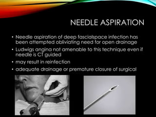 NEEDLE ASPIRATION 
• Needle aspiration of deep fascialspace infection has 
been attempted obliviating need for open drainage 
• Ludwigs angina not amenable to this technique even if 
needle is CT guided 
• may result in reinfection 
• adequate drainage or premature closure of surgical 
 
