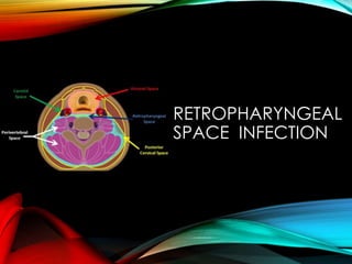 RETROPHARYNGEAL 
SPACE INFECTION 
 