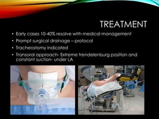 TREATMENT 
• Early cases 10-40% resolve with medical management 
• Prompt surgical drainage – protocol 
• Tracheostomy indicated 
• Transoral approach- Extreme trendelenburg position and 
constant suction- under LA 
 