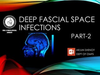 DEEP FASCIAL SPACE 
INFECTIONS 
PART-2 
ARJUN SHENOY 
DEPT OF OMFS 
 