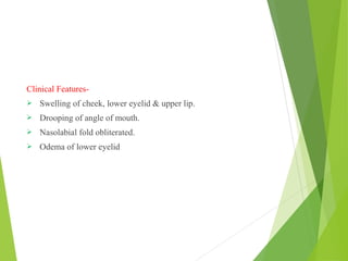 Clinical Features-
 Swelling of cheek, lower eyelid & upper lip.
 Drooping of angle of mouth.
 Nasolabial fold obliterated.
 Odema of lower eyelid
 