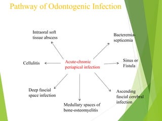 Pathway of Odontogenic Infection
Acute-chronic
periapical infection
Intraoral soft
tissue abscess
Cellulitis
Deep fascial
space infection
Bacteremia-
septicemia
Sinus or
Fistula
Ascending
fascial cerebral
infection
Medullary spaces of
bone-osteomyelitis
 
