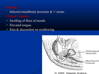 Etiology Infected mandibular premolar & 1st molar.
Clinical Features Swelling of floor of mouth.
 Elevated tongue.
 Pain & discomfort on swallowing.

 