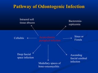 Pathway of Odontogenic Infection
Intraoral soft
tissue abscess

Cellulitis

Bacteremiasepticemia

Acute-chronic
periapical infection

Deep fascial
space infection
Medullary spaces of
bone-osteomyelitis

Sinus or
Fistula

Ascending
fascial cerebral
infection

 