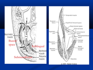 Buccal
space

Sublingual

Submandibular

 