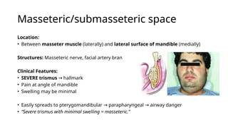 Submasseter Space Fascial Space Infections of Odontogenic Origin.pptx