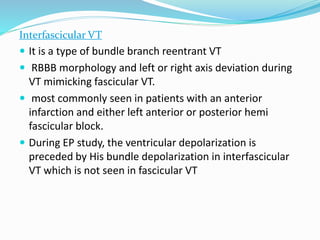 Interfascicular VT
 It is a type of bundle branch reentrant VT
 RBBB morphology and left or right axis deviation during
VT mimicking fascicular VT.
 most commonly seen in patients with an anterior
infarction and either left anterior or posterior hemi
fascicular block.
 During EP study, the ventricular depolarization is
preceded by His bundle depolarization in interfascicular
VT which is not seen in fascicular VT
 