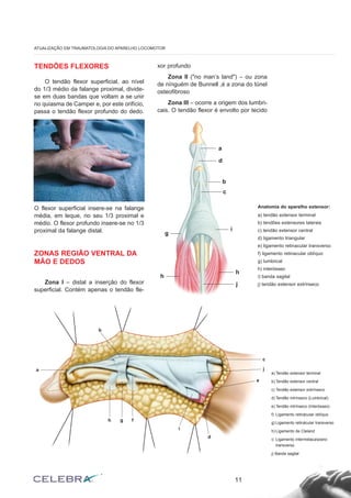 TENDÕES FLEXORES
O tendão flexor superficial, ao nível
do 1/3 médio da falange proximal, divide-
se em duas bandas que voltam a se unir
no quiasma de Camper e, por este orifício,
passa o tendão flexor profundo do dedo.
O flexor superficial insere-se na falange
média, em leque, no seu 1/3 proximal e
médio. O flexor profundo insere-se no 1/3
proximal da falange distal.
ZONAS REGIÃO VENTRAL DA
MÃO E DEDOS
Zona I – distal a inserção do flexor
superficial. Contém apenas o tendão fle-
xor profundo
Zona II ("no man’s land") – ou zona
de nínguém de Bunnell ,é a zona do túnel
osteofibroso
Zona III – ocorre a origem dos lumbri-
cais. O tendão flexor é envolto por tecido
11
ATUALIZAÇÃO EM TRAUMATOLOGIA DO APARELHO LOCOMOTOR
Anatomia do aparelho extensor:
a) tendão extensor terminal
b) tendões extensores laterais
c) tendão extensor central
d) ligamento triangular
e) ligamento retinacular transverso
f) ligamento retinacular oblíquo
g) lumbrical
h) interósseo
i) banda sagital
j) tendão extensor extrínseco
a
d
b
c
i
h
j
h
g
a) Tendão extensor terminal
b) Tendão extensor central
c) Tendão extensor extrínseco
d) Tendão intrínseco (Lumbrical)
e) Tendão intrínseco (Interósseo)
f) Ligamento retinácular oblíquo
g) Ligamento retinácular transverso
h) Ligamento de Cleland
i) Ligamento intermetacarpiano
transverso
j) Banda sagital
a
h
b
g f
d
e
c
j
i
 