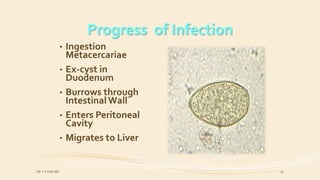 • Ingestion
Metacercariae
• Ex-cyst in
Duodenum
• Burrows through
Intestinal Wall
• Enters Peritoneal
Cavity
• Migrates to Liver
Progress of Infection
DR.T.V.RAO MD 19
 