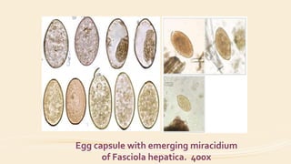 Egg capsule with emerging miracidium
of Fasciola hepatica. 400x
 
