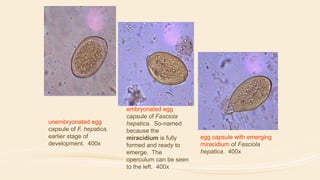 egg capsule with emerging
miracidium of Fasciola
hepatica. 400x
unembryonated egg
capsule of F. hepatica.
earlier stage of
development. 400x
embryonated egg
capsule of Fasciola
hepatica. So-named
because the
miracidium is fully
formed and ready to
emerge. The
operculum can be seen
to the left. 400x
 