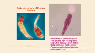 Redia and cercaria of Fasciola
hepatica
Miracidium of Fasciola hepatica.
This ciliated, non-feeding larval
stage, has about 24 hours to find
its specific snail host, such as
Fossaria modicella or Stagnicola
bulimoides. 400x
 