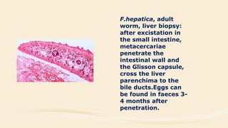 F.hepatica, adult
worm, liver biopsy:
after excistation in
the small intestine,
metacercariae
penetrate the
intestinal wall and
the Glisson capsule,
cross the liver
parenchima to the
bile ducts.Eggs can
be found in faeces 3-
4 months after
penetration.
 