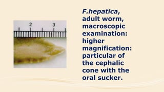 F.hepatica,
adult worm,
macroscopic
examination:
higher
magnification:
particular of
the cephalic
cone with the
oral sucker.
 